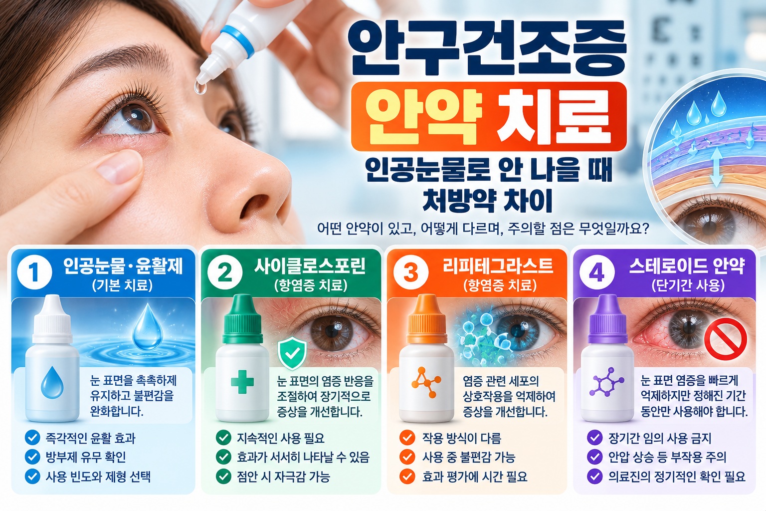 안구건조증 안약 치료에 사용하는 인공눈물, 사이클로스포린, 리피테그라스트, 스테로이드 점안제의 역할과 차이, 사용 시 주의사항을 비교한 의료정보 이미지