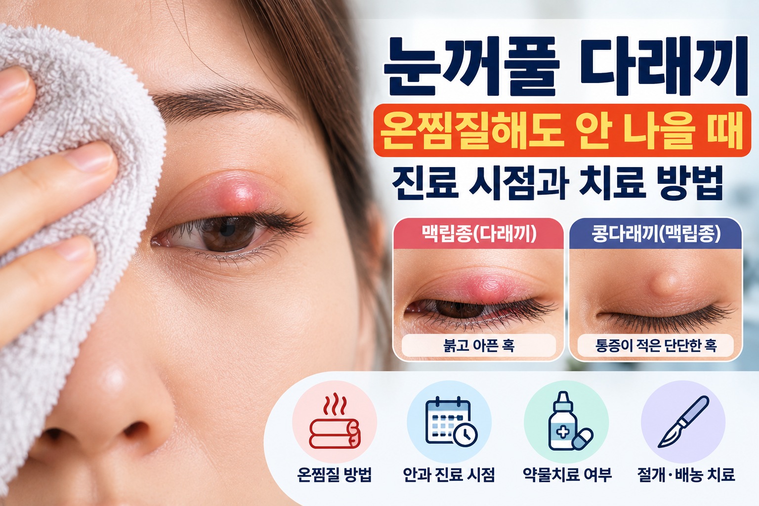 눈꺼풀 다래끼 온찜질에도 낫지 않을 때 맥립종과 콩다래끼의 차이, 안과 진료 시점, 약물치료 및 절개·배농 치료 방법을 안내하는 이미지