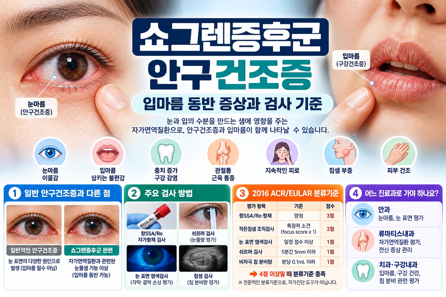 쇼그렌증후군 안구건조증의 눈마름·입마름 동반 증상과 일반 안구건조증의 차이, 항SSA/Ro 자가항체 검사, 쉬르머 검사, 침샘 검사 및 진료과별 확인 사항을 설명하는 의료정보 이미지